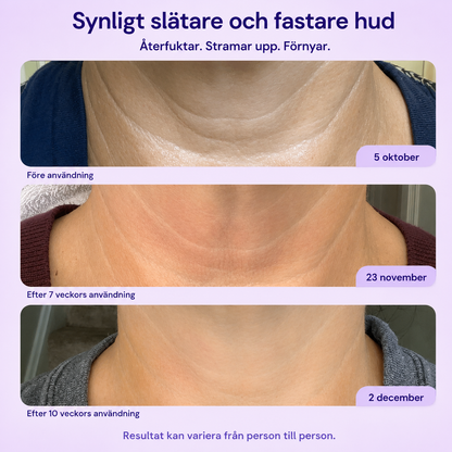 Sorva Halskräm för hals och dekolletage